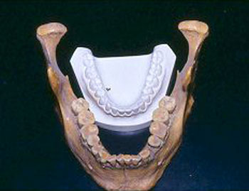 Giant Teeth